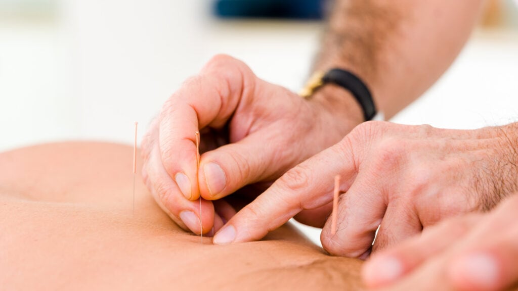 Begleitende Therapien